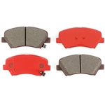 Order TRANSIT WAREHOUSE - SIM-1543 - Front Semi Metallic Pads For Your Vehicle