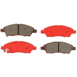 Order TRANSIT WAREHOUSE - SIM-1592 - Front Semi Metallic Pads For Your Vehicle