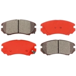 Order TRANSIT WAREHOUSE - SIM-924 - Front Semi Metallic Pads For Your Vehicle